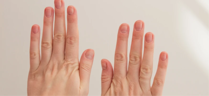 image showing hand with long fingers